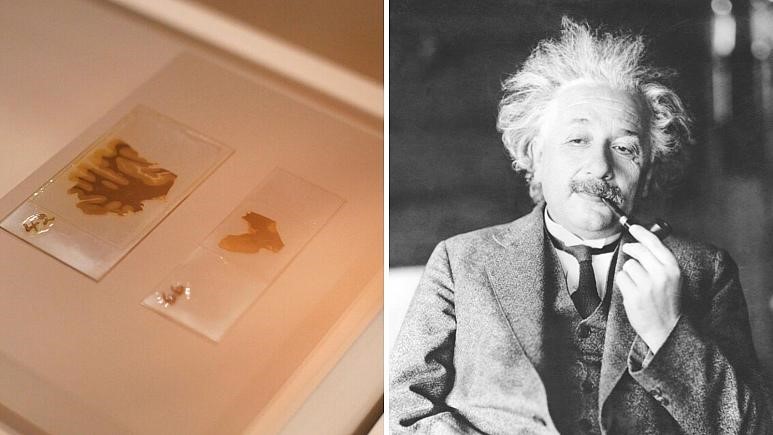 مغز آلبرت اینشتین