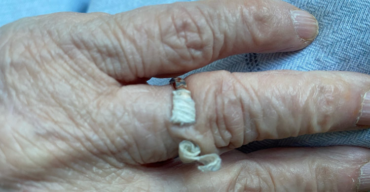 دزدی انگشتر در بیمارستان