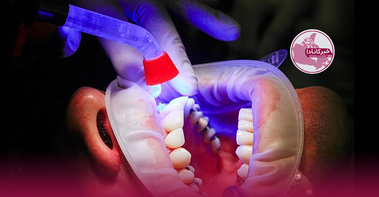 تولید مینای دندان با سلول‌های بنیادی